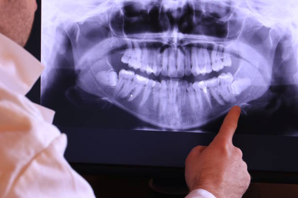 Best Weekend Emergency Dentist in Burnham, PA