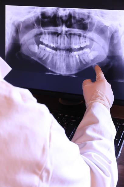 Best Emergency Dental Care for Abscessed Tooth in Burnham, PA