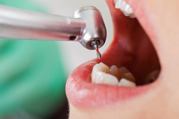 Best Emergency Dental Care for Abscessed Tooth in Burnham, PA